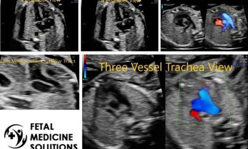 Fetal-Echocardiography01
